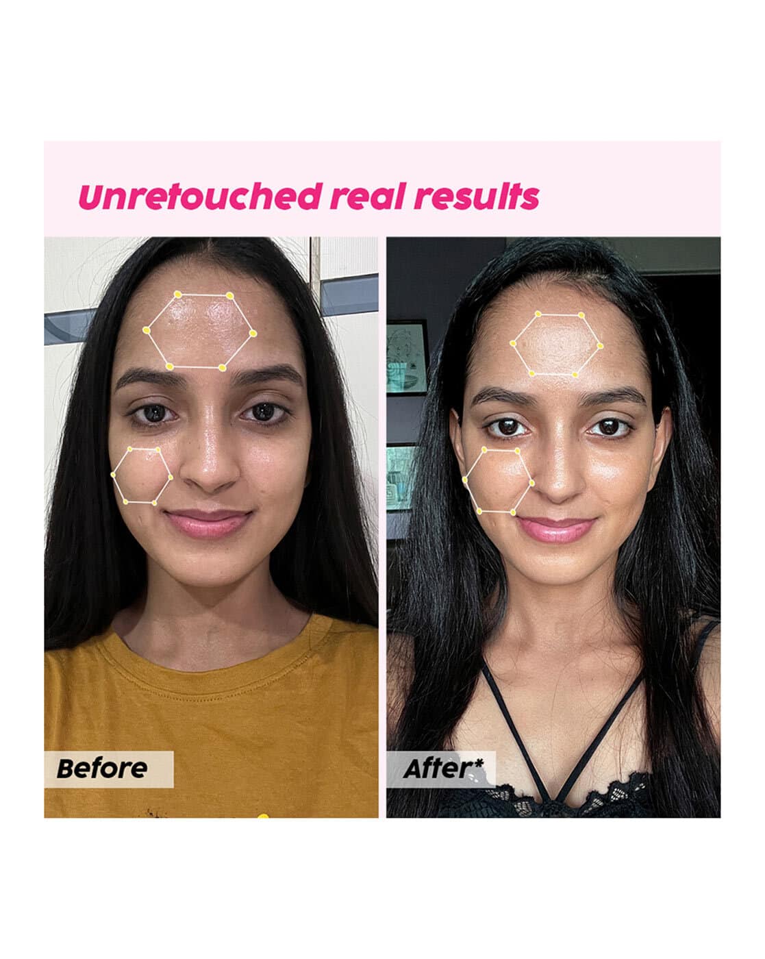 plix glutathione before and after Buy Plix Glutathione Skin Glow Efferve... Online