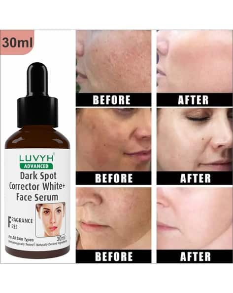 LUVYH Women Skin Brightening + Dark Spot Serum